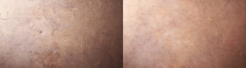 Scratch Removing Technique