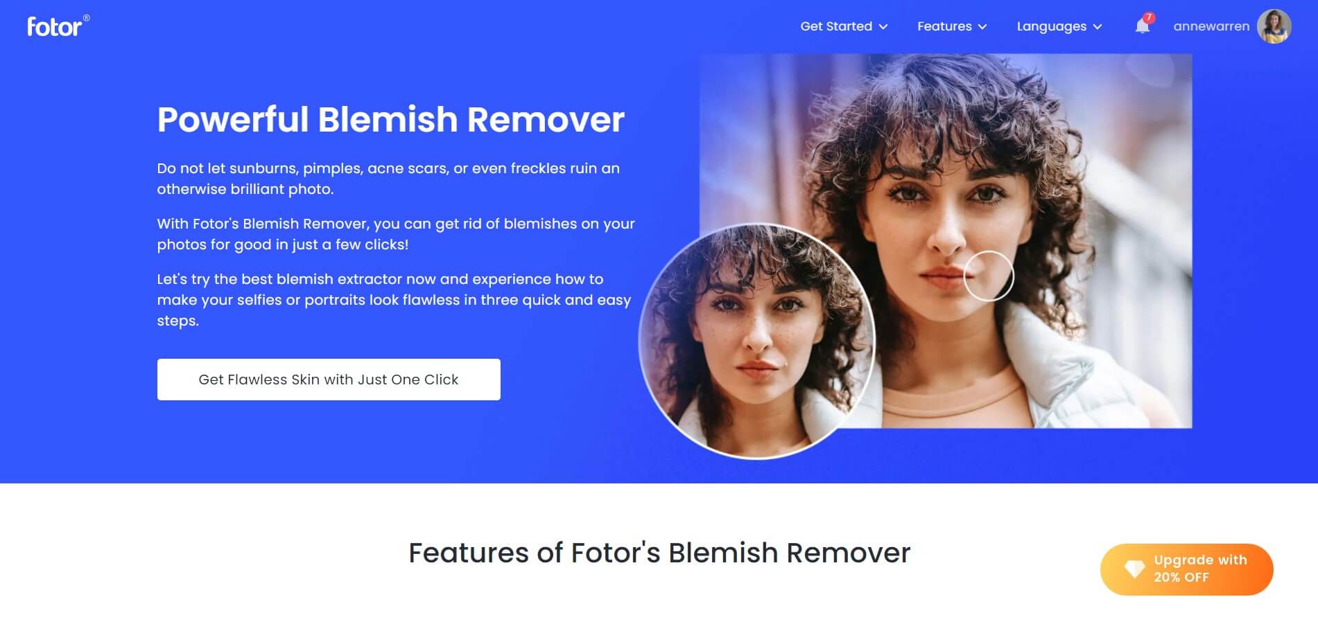 Fotor blemish remover
