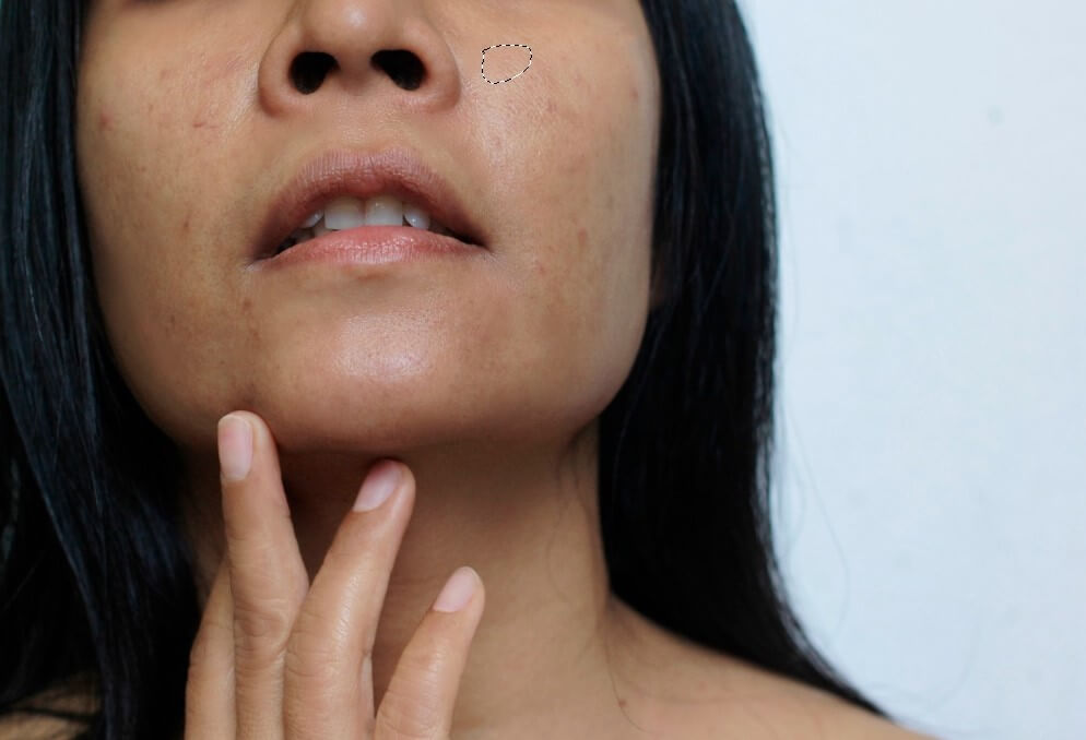 Patch Tool reference