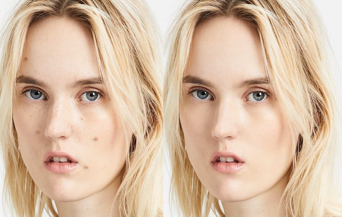 Spot Removing Technique